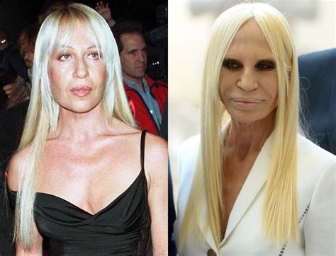 donatella versace figli|Donatella Versace before and after surgery.